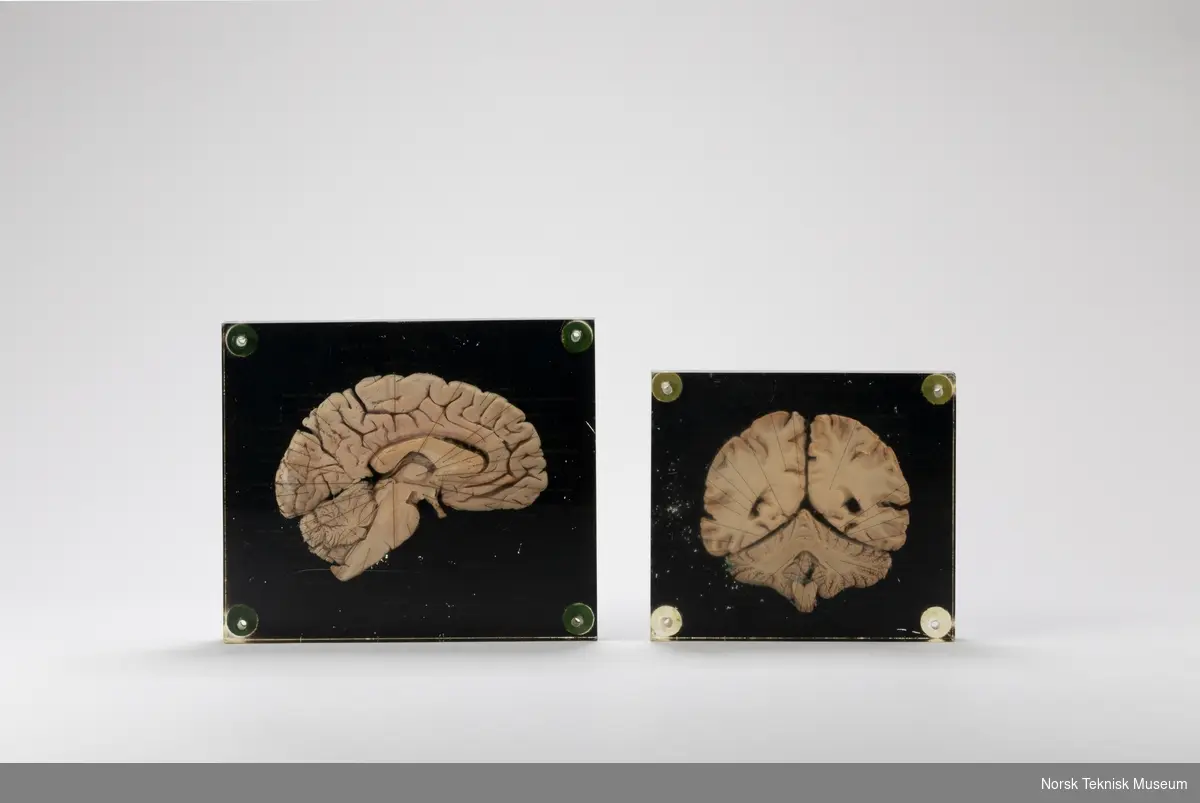 Tverrsnitt av hjerne i glasslignende materiale med påført tekst som viser til forskjellige hjernedelene med svart bakgrunn.
