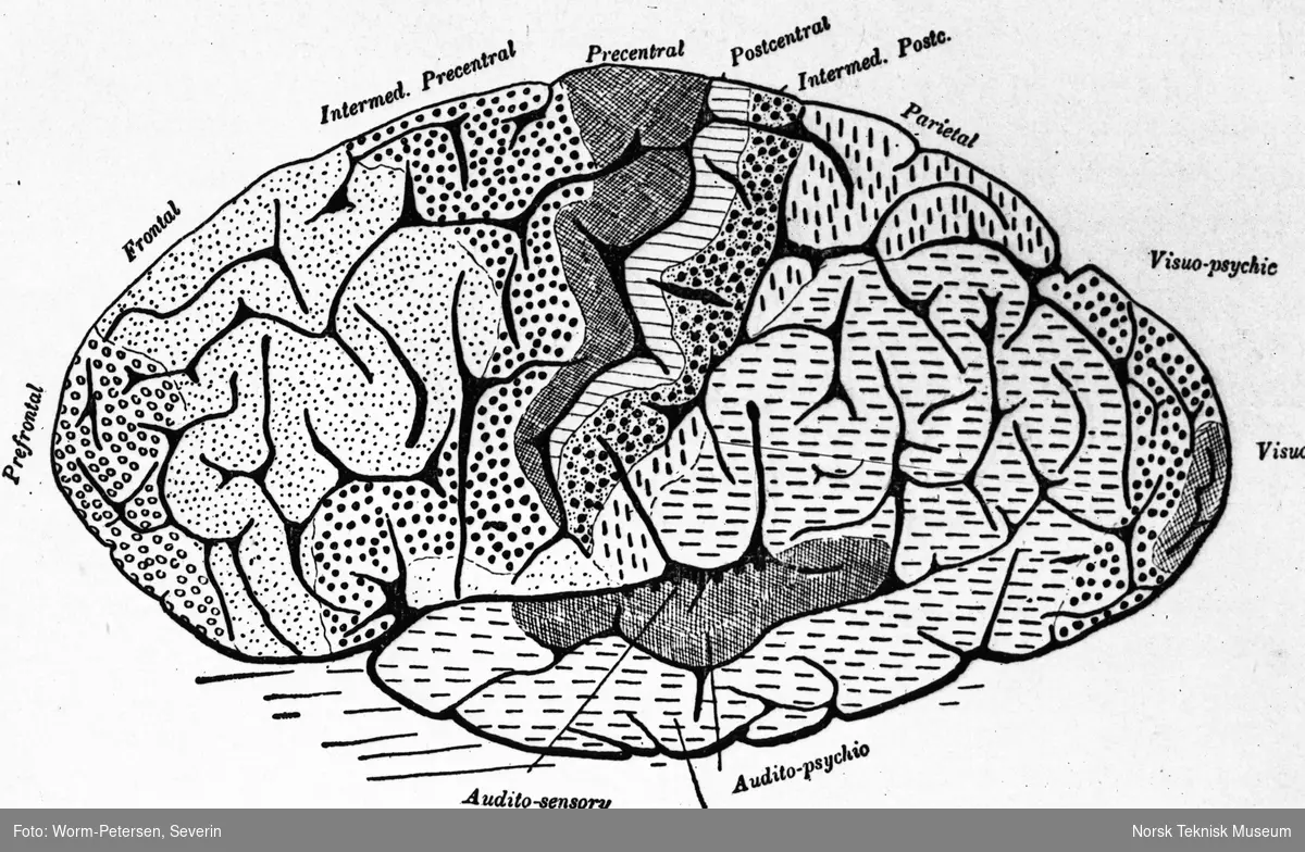 Illustrasjon, menneskets hjerne