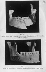 Tandlæge Dybring 8/12 24