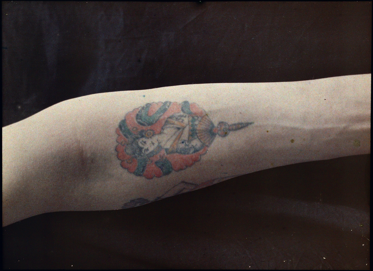 Agfa-autokrom. Medicinska fotografier.
Tatuering på underarm.
