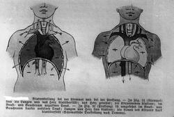 Dr. Torgersen nov. 1917