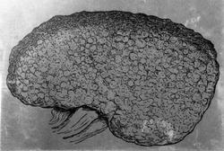 ... Skrumpnyre... Fig. 237.